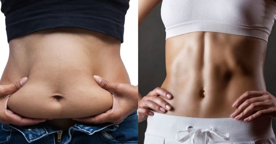 Gordura localizada na barriga (Foto: Montagem/TV Foco)