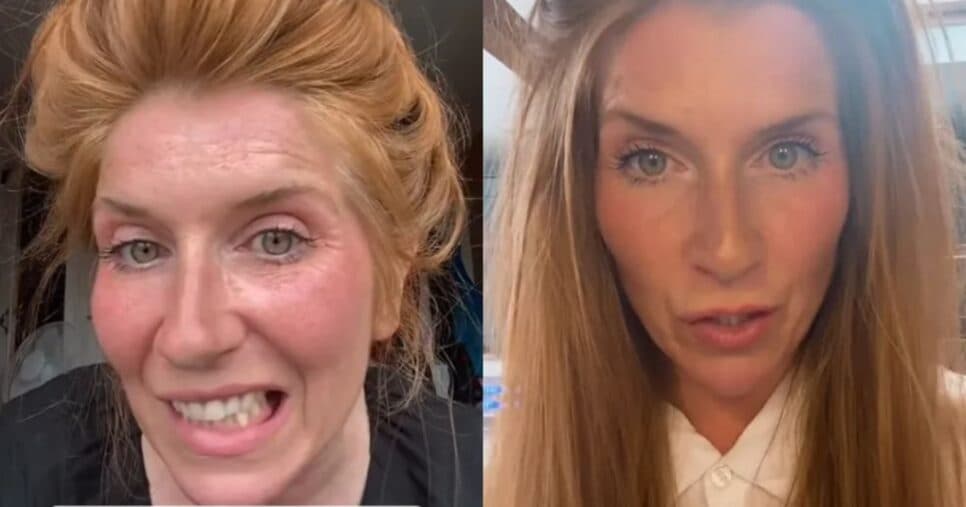 Antes e depois de Kate Antes e depois de Kate