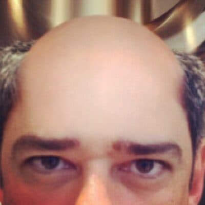Willian Bonner posta foto careca; confira!