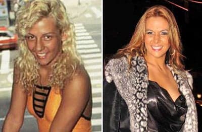 Carla Perez faz nova plástica e mexe no nariz; confira!