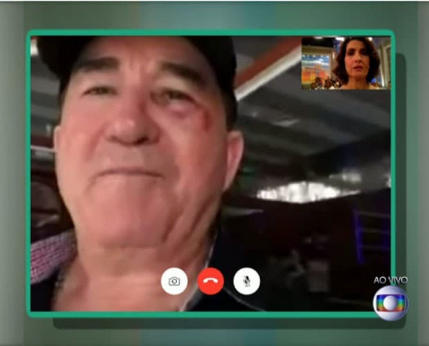 Amado Batista mostra como ficou o rosto após ser apedrejado em show