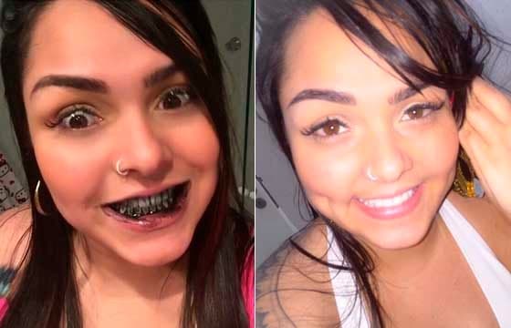 Oi? Mulher Melancia clareia dentes com carvão; veja foto
