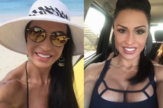 Gracyanne Barbosa gasta R$ 80 mil para ostentar dentes mais brancos