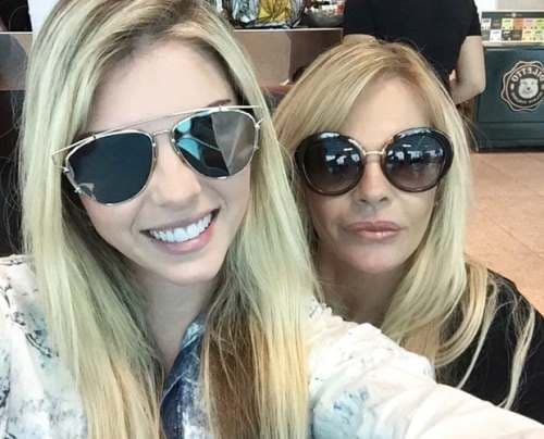 Monique Evans é criticada por botox na web