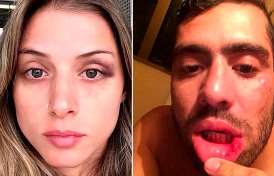 Angela Sousa relembra suposta agressão do ex-namorado: "tem noite que desabo"