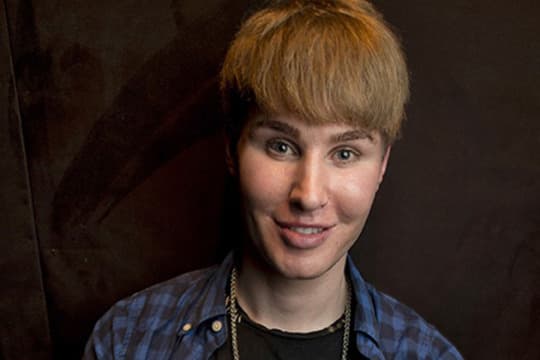 Homem que gastou R$ 350 mil em plásticas para parecer Justin Bieber desaparece na Califórnia