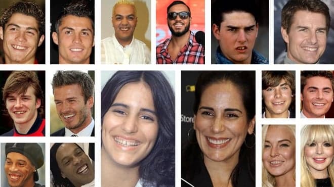 'Arquiteto dos dentes', Emerson Albuquerque revela segredos do sorriso das celebridades