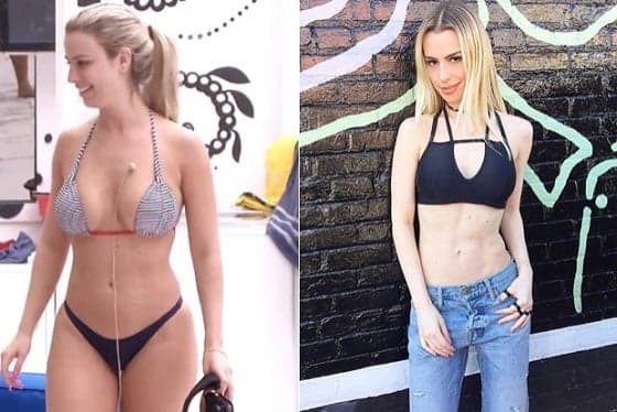 Fernanda Keulla nega anorexia após surpreender com magreza