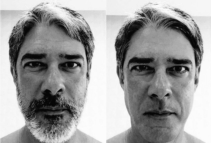 William Bonner posta foto de antes e depois e surpreende nas redes sociais