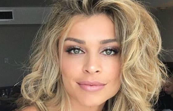 Grazi Massafera usa botox no rosto e confessa: "O resultado foi ótimo"