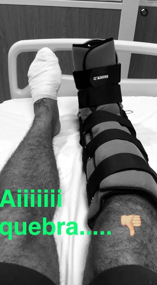 Caio Castro quebra dedo durante Carnaval: "Acabou"
