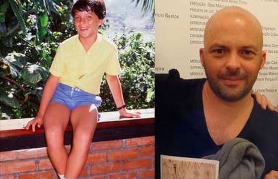 Morre ator que fez Pedrinho em "Sítio do Pica Pau Amarelo"