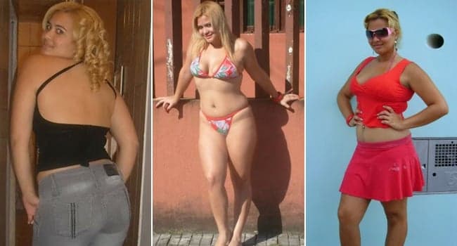 Vaidade! Confira alguns famosos que mudaram radicalmente após plásticas
