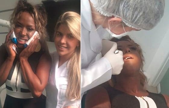 Ex-BBB Adélia faz cirurgia para retirada das bochechas: "Amo me cuidar"