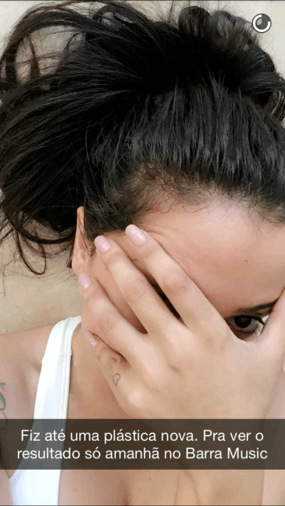 Anitta faz piada com fãs: 'Fiz plástica nova'