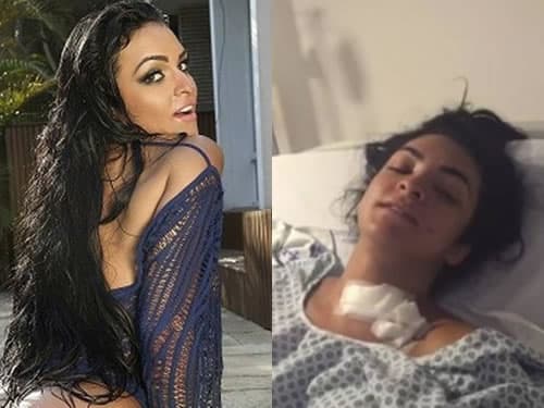 Miss Bumbum Paraíba tenta suicídio e fica paraplégica