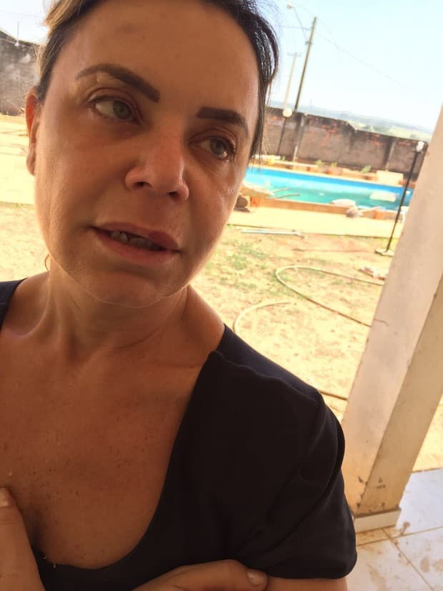 Confira hematomas sofridos por Flor após agressão de bandidos
