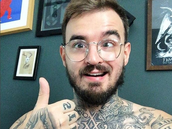 Youtuber faz cirurgia e deixa de ser vesgo; veja o resultado!