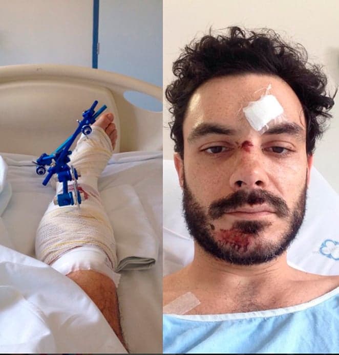 Ator de "Os Dez Mandamentos" sofre grave acidente e deve ficar sem andar por um tempo