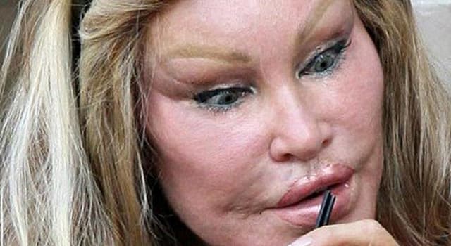 Socialite chama atenção na web por excesso de cirurgias plásticas