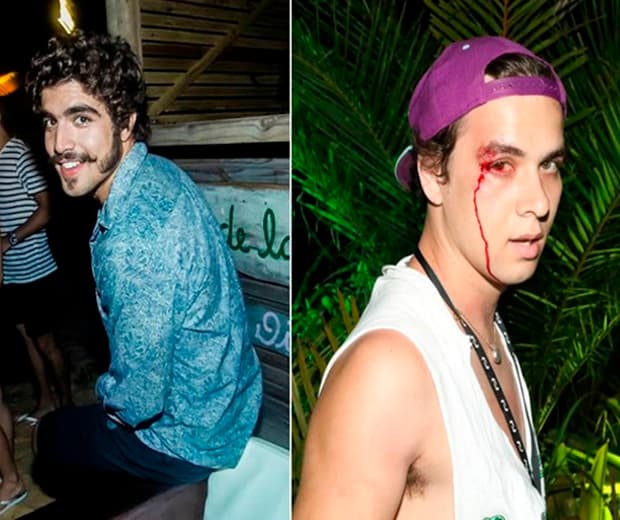 Caio Castro fala pela primeira vez  sobre agressão à fotógrafo