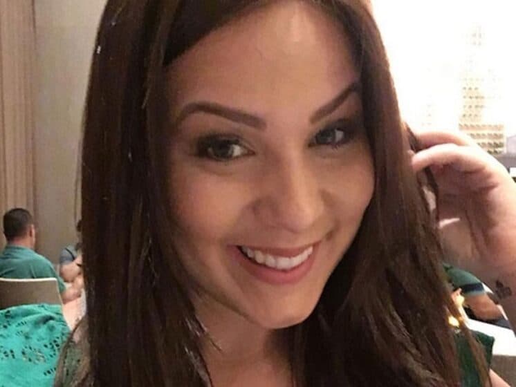 Ex-BBB Cacau recorre ao botox e aplicação labial