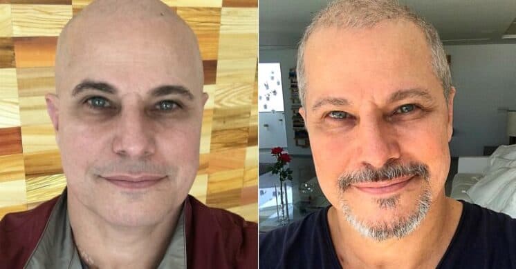 Edson Celulari fala pela primeira vez na TV sobre sua recuperação e volta a novela