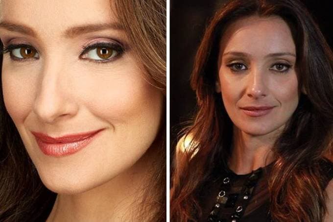 Sabrina Parlatore mostra cabelo diferente após quimioterapia