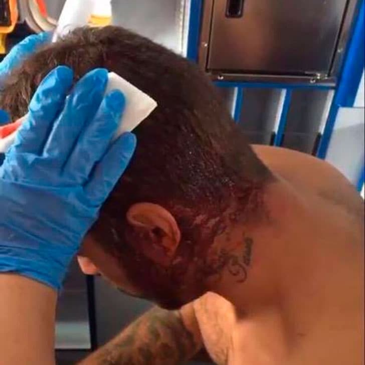 Pedro Scooby sofre acidente surfando em Portugal