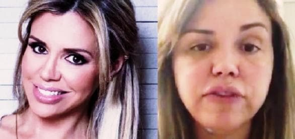 Renata Banhara perde parte dos movimentos do rosto