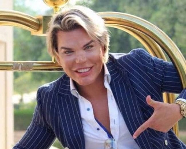 Com risco de perder o nariz, Ken Humano ignora alerta médico e fará nova rinoplastia