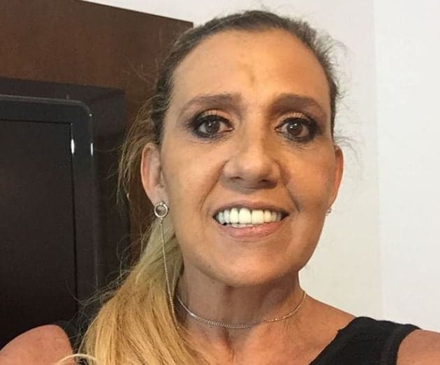 Após procedimentos estéticos de R$ 100 mil, Rita Cadilac mostra barriga sarada