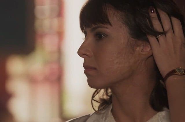 "Tempo de Amar": Tragédia no passado deixou cicatriz no rosto de Lucinda