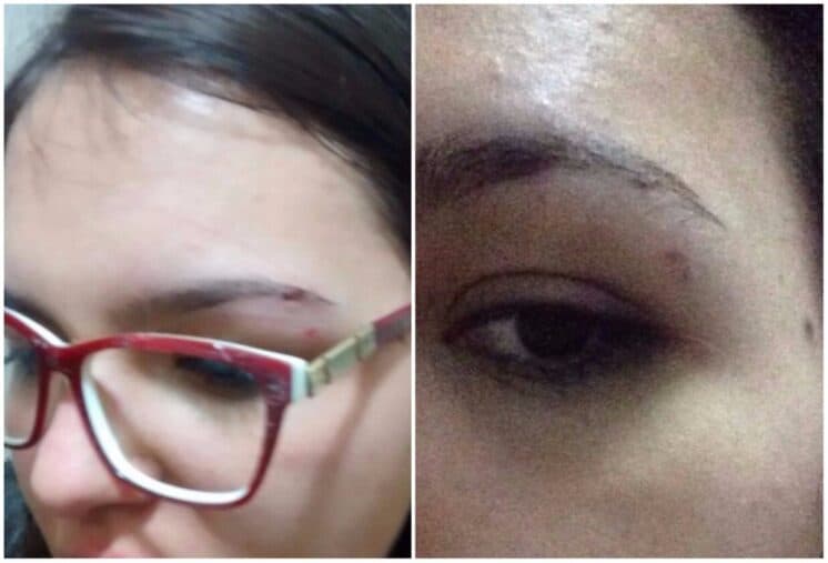 Ator da Globo é acusado de agredir mulher e causar edema: "Que a Justiça faça o que deve ser feito"