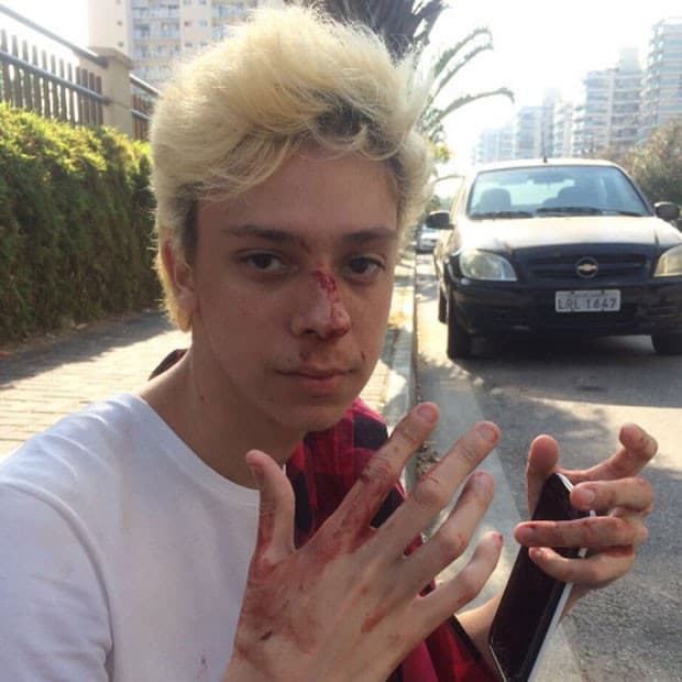 Ator é vítima de homofobia e aparece sangrando no Rio de Janeiro