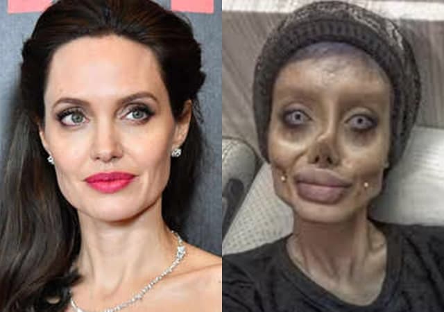 Mulher faz 50 cirurgias para parecer Angelina Jolie e resultado é assustador