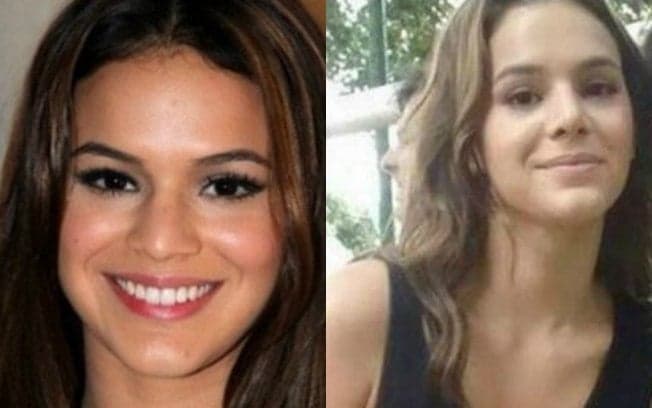 Conheça 3 famosas que negam plásticas, mas fotos antigas mostram o contrário