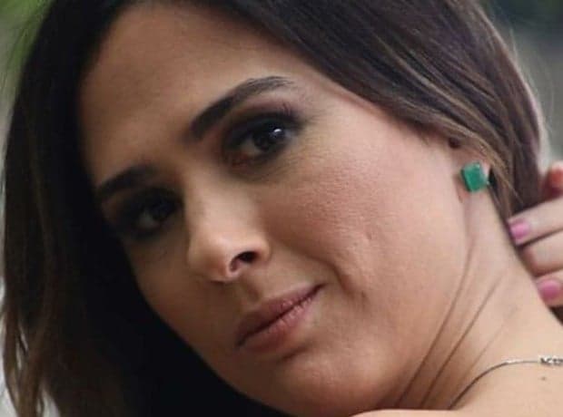 Tatá Werneck fala sobre o uso de botox após pergunta de fã