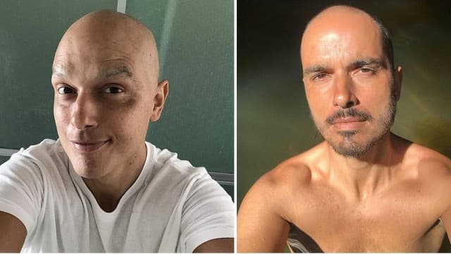 Leo Rosa, ator da Record, fala de terapia com injeção de café e água no ânus: "É uma coisa que eu faço diariamente”
