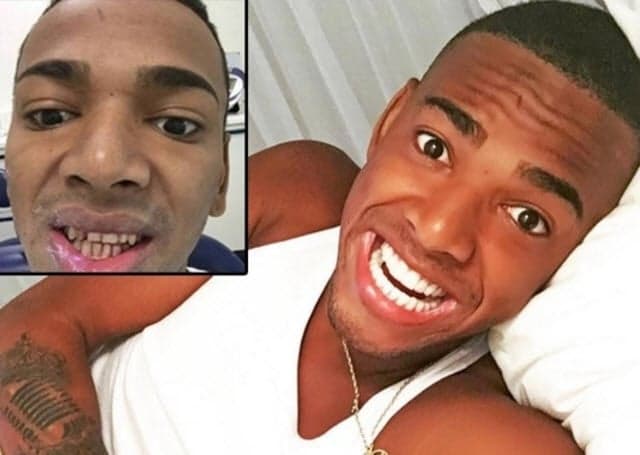 Conheça os famosos que mudaram os dentes e ficaram diferentes