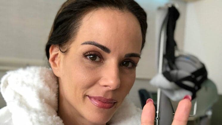 Na luta contra câncer, Ana Furtado revela queda de cabelo e faz desabafo