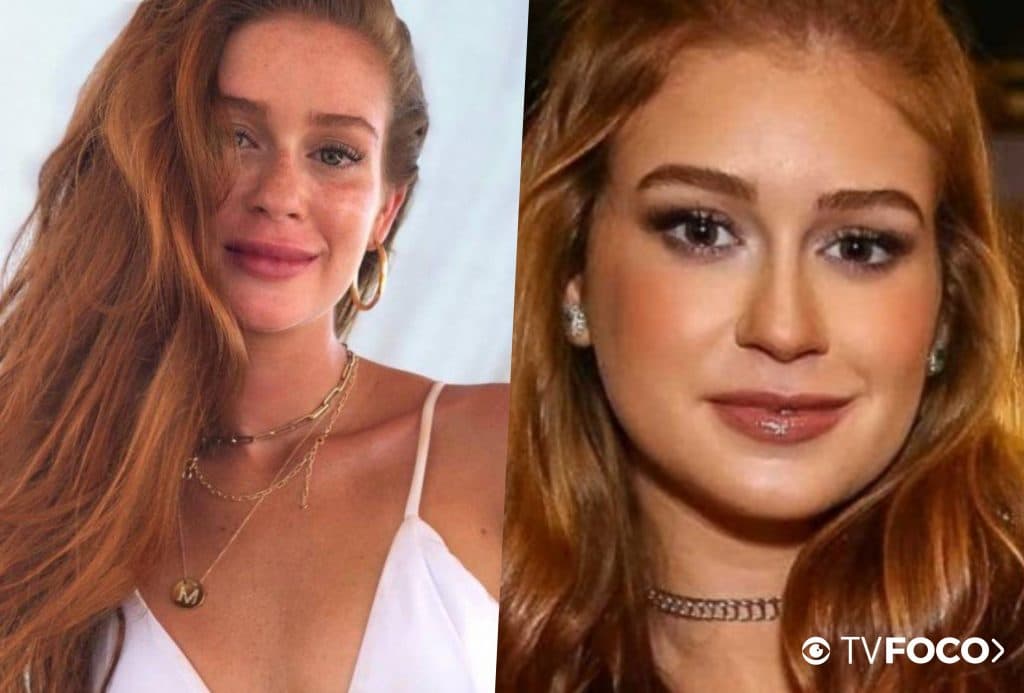 Marina Ruy Barbosa fez ou não procedimento nos lábios 