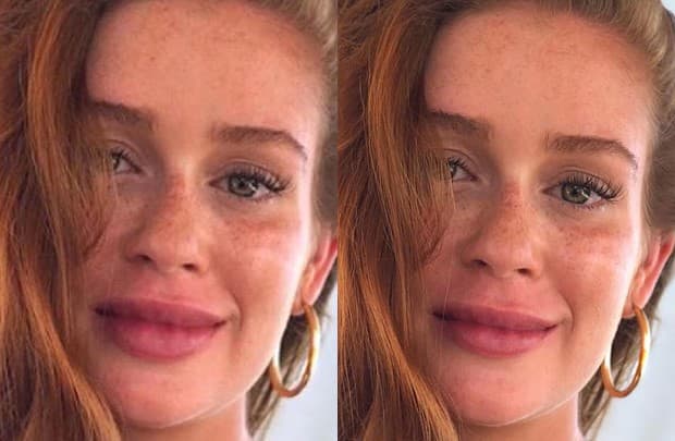 Após aparecer com a boca mais 'carnuda', Marina Ruy Barbosa se pronuncia e nega preenchimento