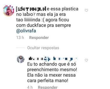 Marina Ruy Barbosa teria feito procedimento