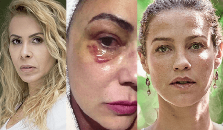 Joelma, Luiza Brunet e Luana Piovani. Famosas que foram agredidas pelos próprios companheiros