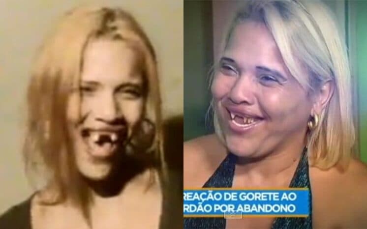 Gorete que virou Gisele perde os dentes novamente e é socorrida pela Record