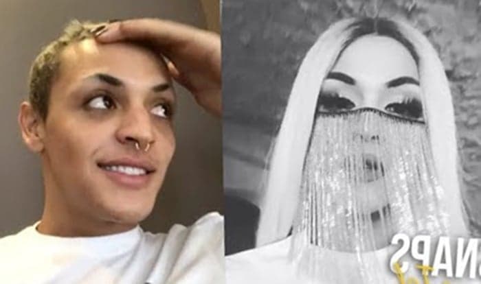 Pabllo Vittar passa por um processo cirúrgico no joelho, mas garante estar bem