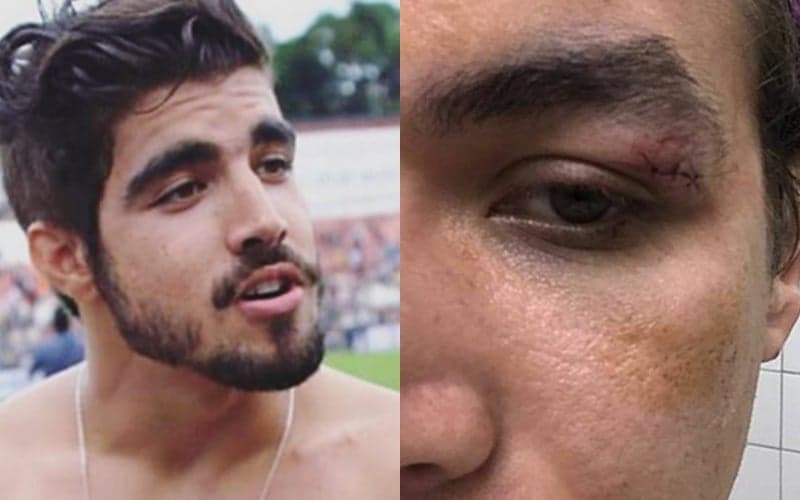 Caio Castro é condenado a pagar fortuna em indenização por agressão a fotógrafo