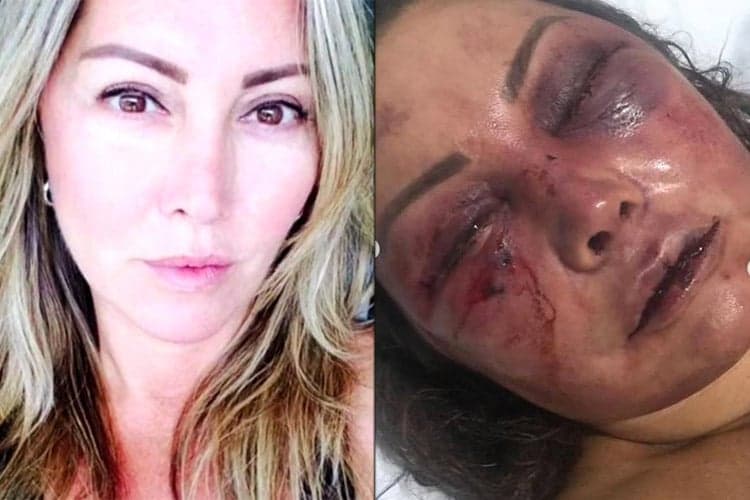 Record faz chamada sobre mulher espancada por 4 horas e é detonada por abordagem