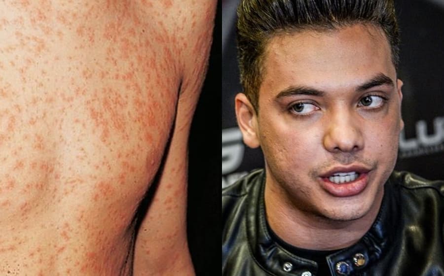Cruzeiro com Wesley Safadão tem surto de doença contagiosa e cantor corre o risco de contrair